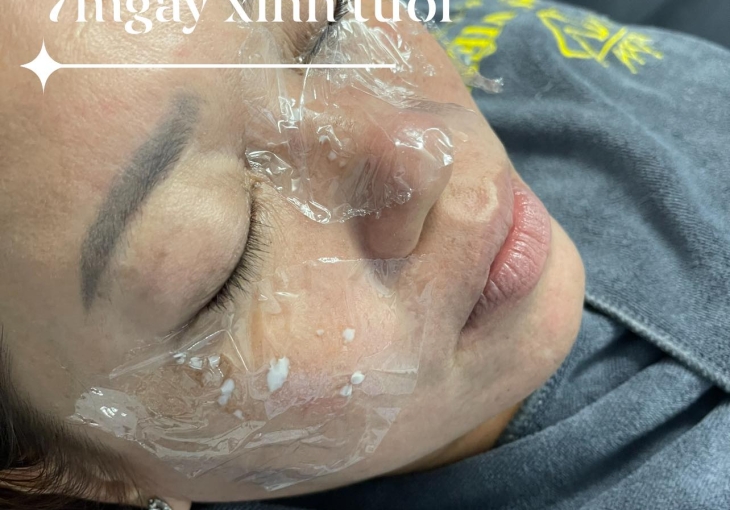 Đốt Tàn Nhan, Mụn Thịt, Nốt Ruồi