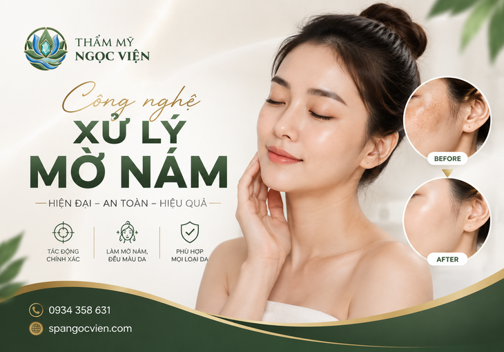 Công Nghệ Xử Lý Mờ Nám Hiện Đại: Đâu Là Giải Pháp Phù Hợp?