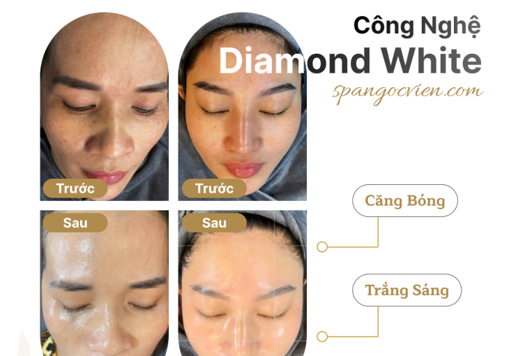 TẾT RỰC RỠ VỚI CÔNG NGHỆ DIAMOND WHITE: DA CĂNG BÓNG, TRẮNG SÁNG CHỈ 99K TẠI NGỌC VIỆN