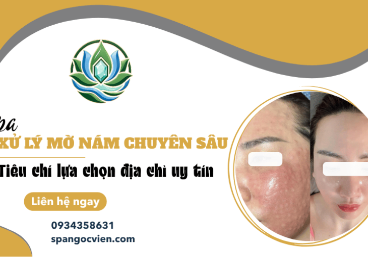 Spa xử lý mờ nám chuyên sâu: Tiêu chí lựa chọn địa chỉ uy tín