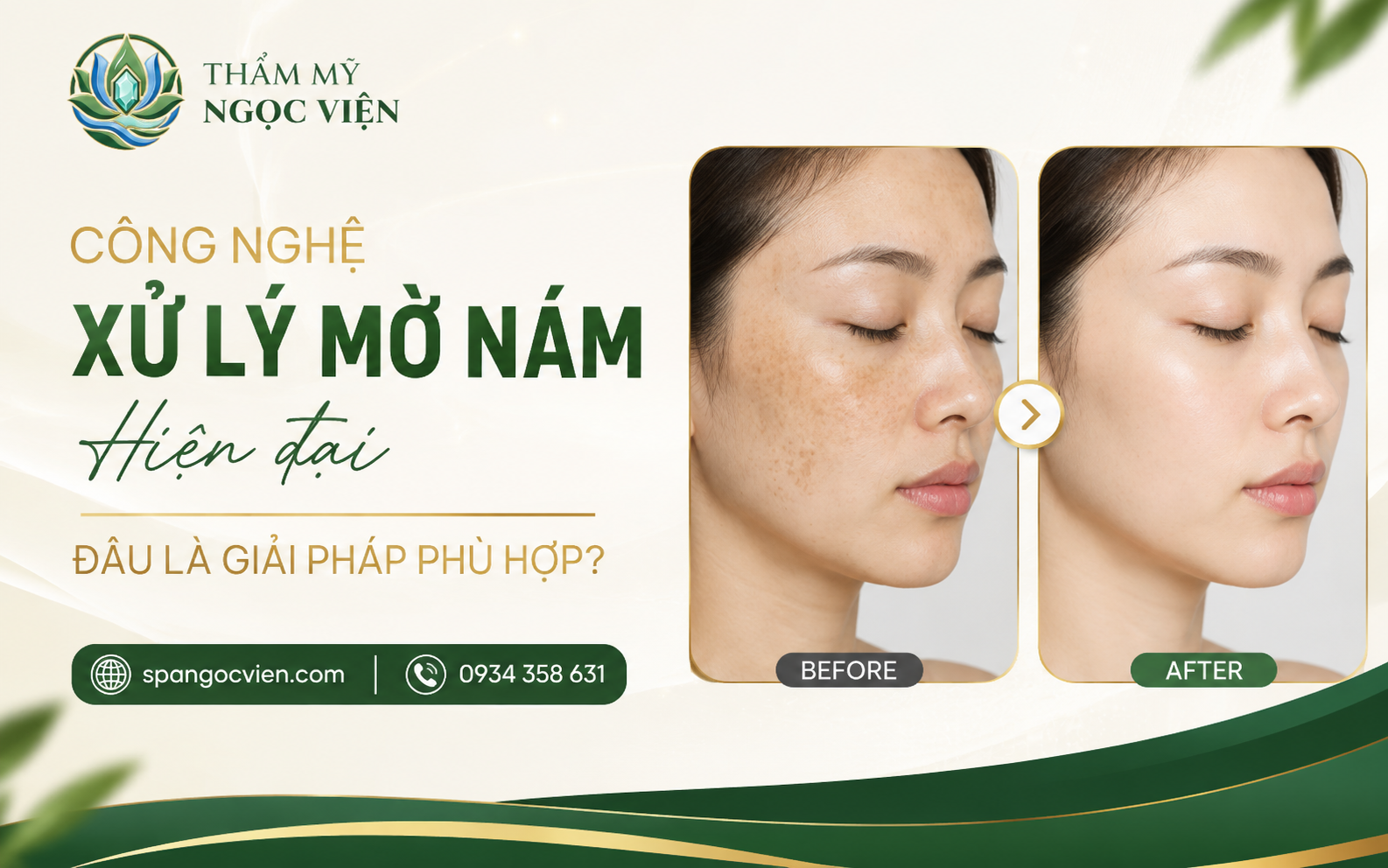 Thẩm Mỹ Ngọc Viện – Chăm sóc da và hỗ trợ cải thiện sắc tố