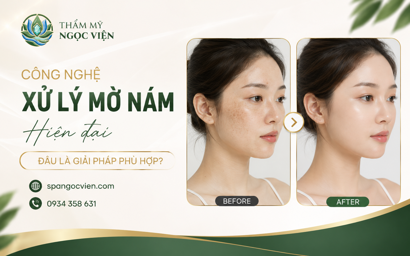 Thẩm Mỹ Ngọc Viện – Chăm sóc da và hỗ trợ cải thiện sắc tố