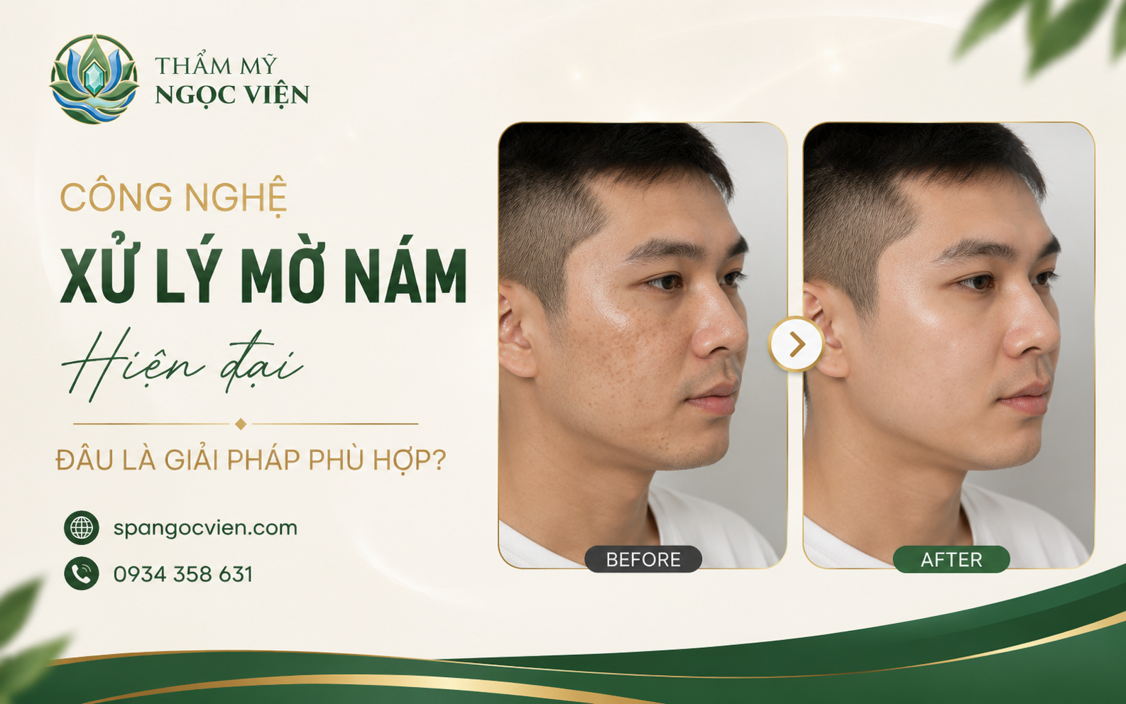 Thẩm Mỹ Ngọc Viện – Chăm sóc da và hỗ trợ cải thiện sắc tố