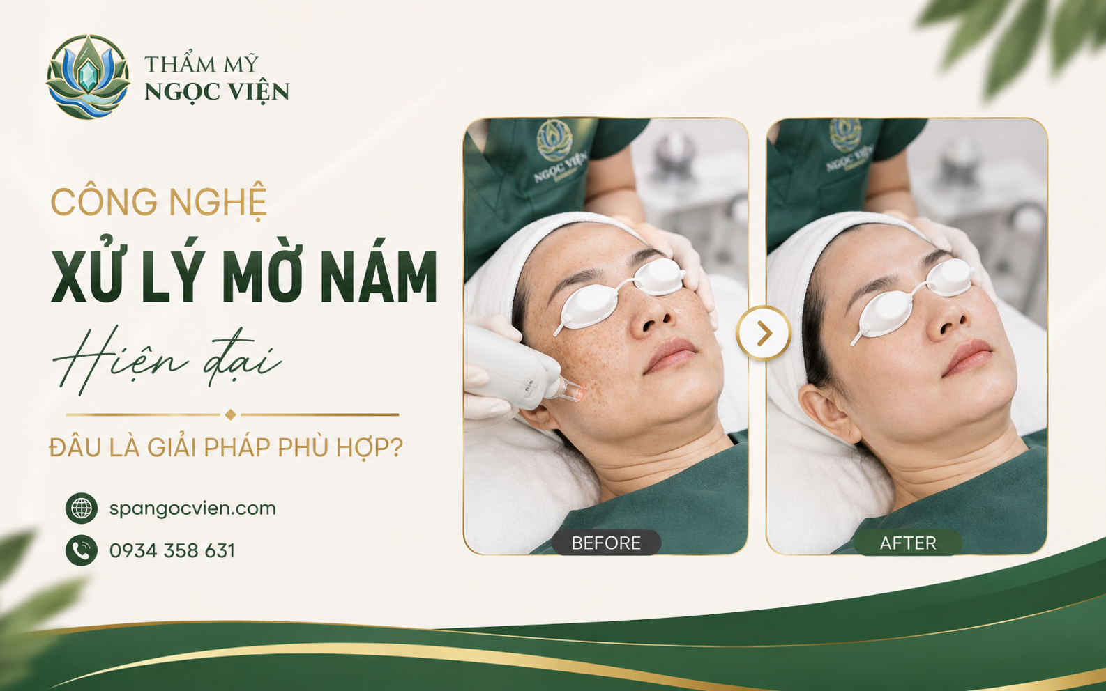 Thẩm Mỹ Ngọc Viện – Chăm sóc da và hỗ trợ cải thiện sắc tố