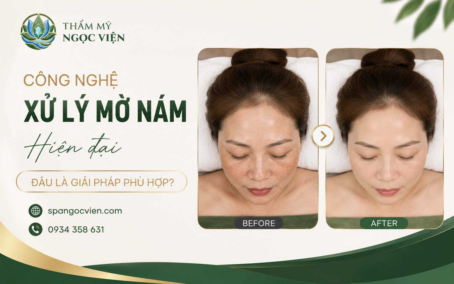 Thẩm Mỹ Ngọc Viện – Chăm sóc da và hỗ trợ cải thiện sắc tố