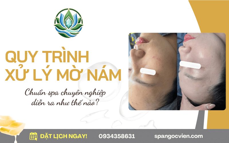quy trình xử lý mờ nám