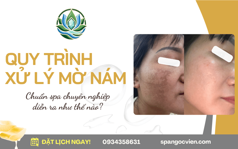 quy trình xử lý mờ nám