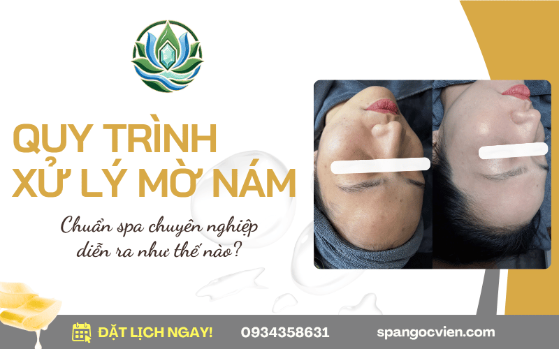 quy trình xử lý mờ nám