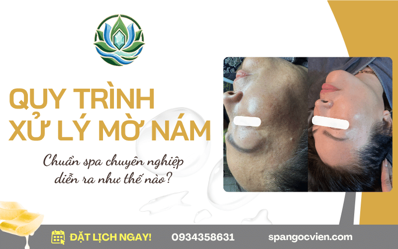 quy trình xử lý mờ nám