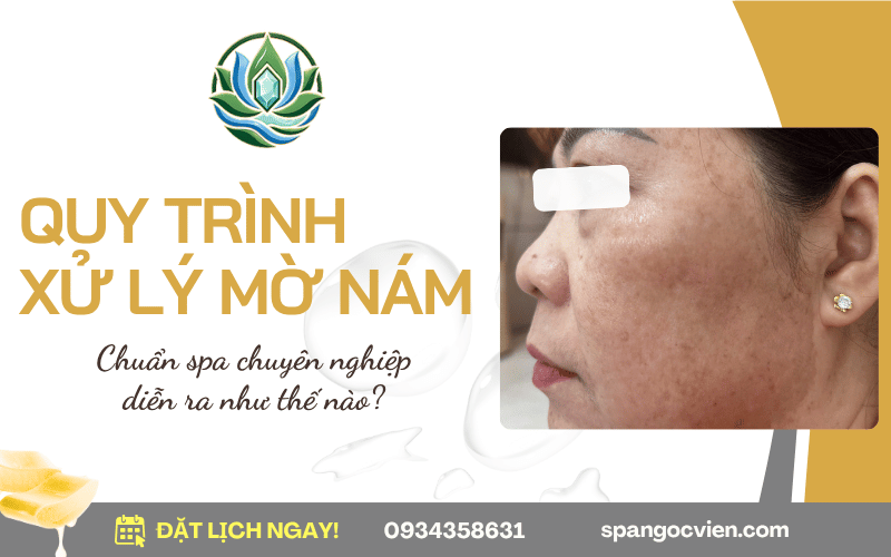 quy trình xử lý mờ nám