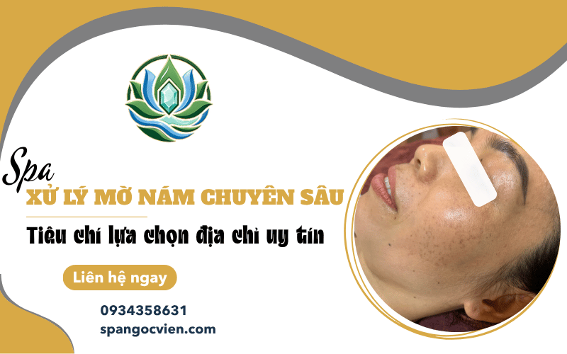 spa xử lý mờ nám