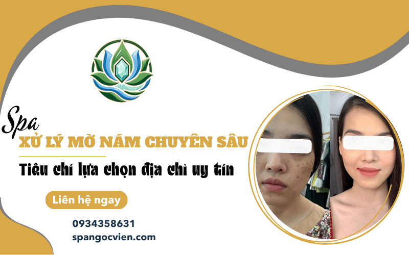 spa xử lý mờ nám
